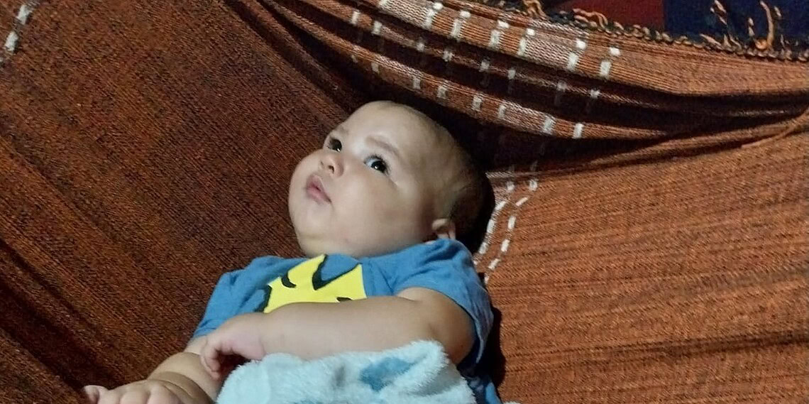 Família pede ajuda para custear cirurgia de emergência em bebê com encefalopatia no Acre