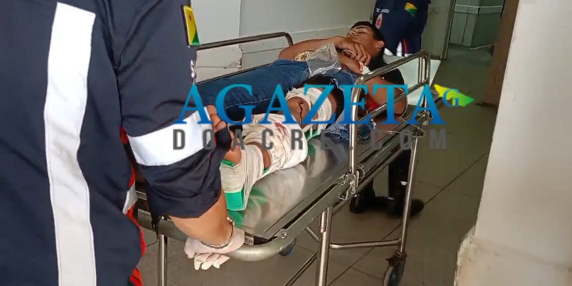 Jovem sofre fratura grave em colisão entre moto e quadriciclo, na Transacreana