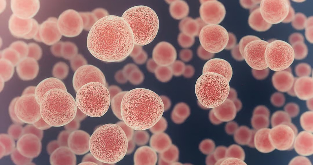 Foto: iStock/Jezperklauzen