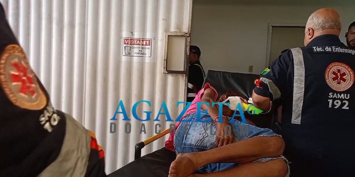 Idosa de 70 anos é atropelada na Baixada do Sobral e sofre afundamento de crânio