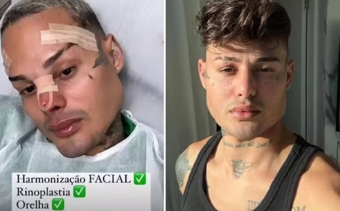 Influenciador diz que gastou mais de R$ 100 mil para 'ficar a cara' de Cauã Reymond e viraliza