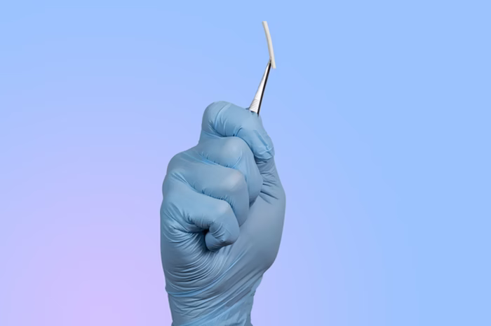 Sobre o chip: veja novas regras da Anvisa para implantes hormonais