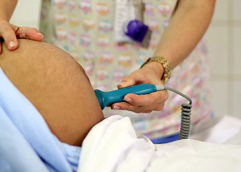 Foto: Rodrigo Nunes/MS