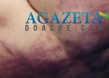 Homem é brutalmente agredido com golpes de ripa na Baixada da Sobral, em Rio Branco