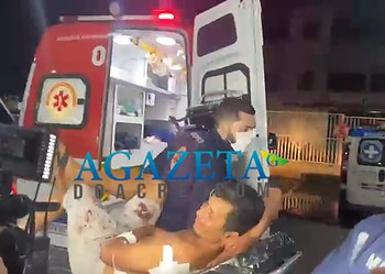 Mulher esfaqueia marido após ser agredida por mordidas