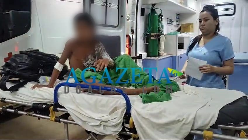 Criança indígena sofre queimaduras graves após choque elétrico e é transferida para Rio Branco