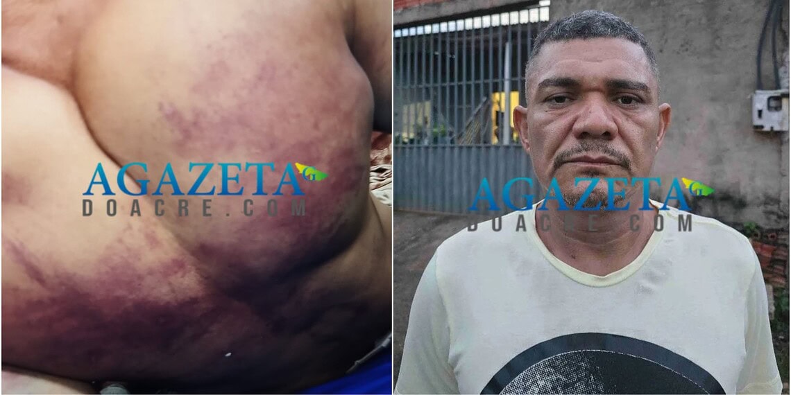Homem espancado a golpes de ripa na Baixada da Sobral morre no Pronto Socorro de Rio Branco