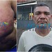 Homem espancado a golpes de ripa na Baixada da Sobral morre no Pronto Socorro de Rio Branco