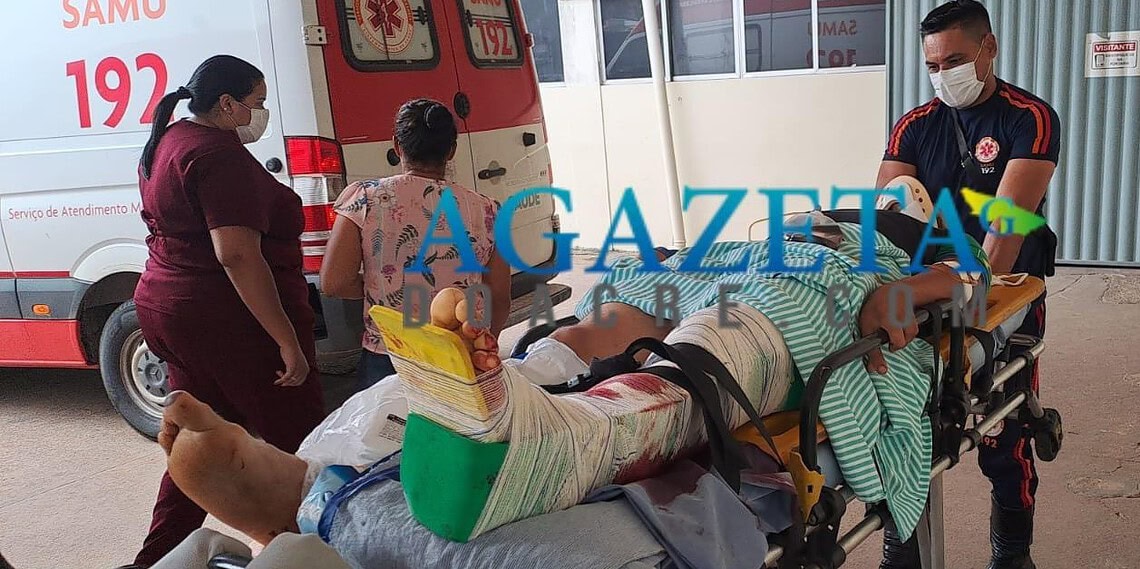 ACIDENTE GRAVE! Colisão entre duas motocicletas deixa homem com fratura exposta