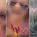 Cuidadora mandou a idosa dizer aos familiares que os ferimentos foram causados por uma queda no banheiro • Reprodução/ Polícia Civil