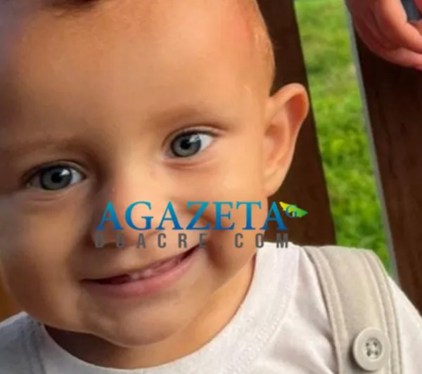 Bebê de 11 meses morre após sofrer queimaduras graves em Porto Acre