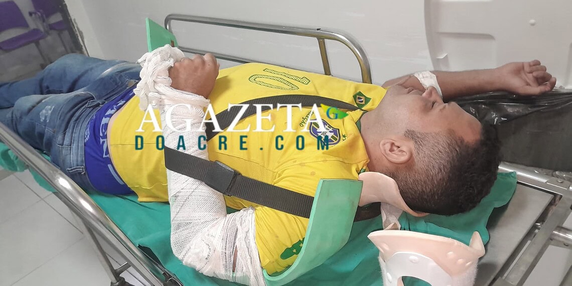 Motociclista sofre fratura no braço após colisão com caminhonete no interior do AC