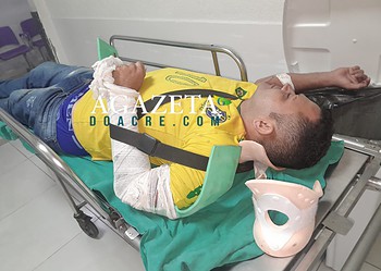 Motociclista sofre fratura no braço após colisão com caminhonete no interior do AC