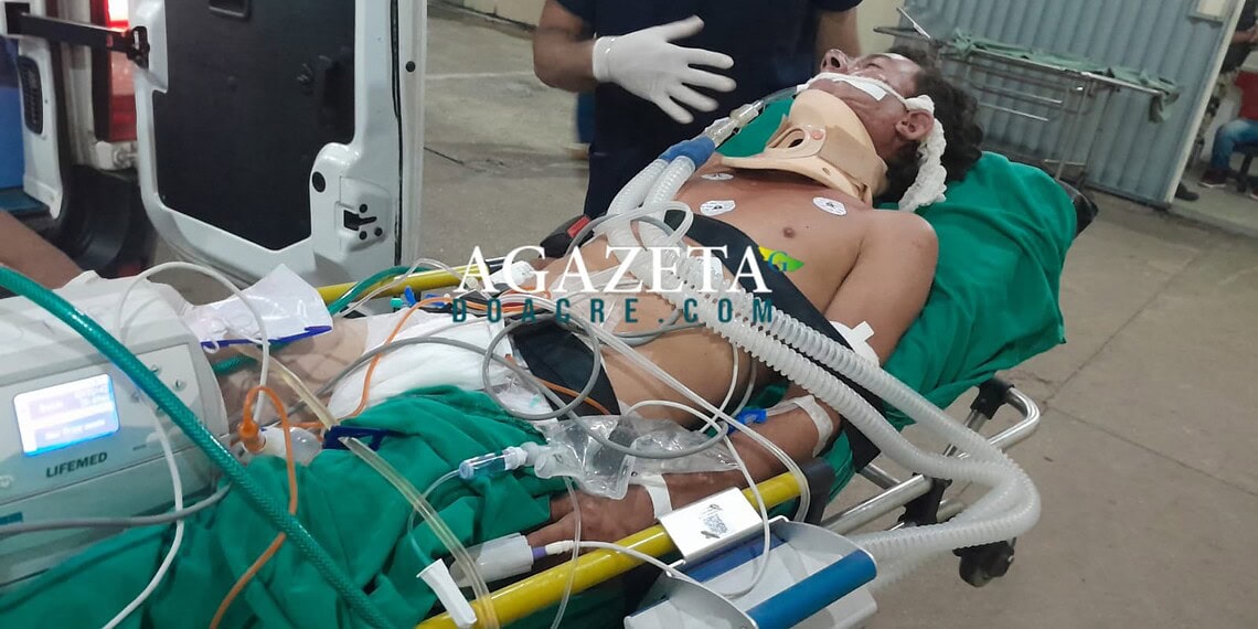 Motociclista sofre acidente e é transferido em estado grave no interior do Acre
