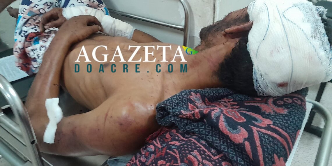 Homem é brutalmente agredido por facção criminosa após ser acusado de furto em Rio Branco
