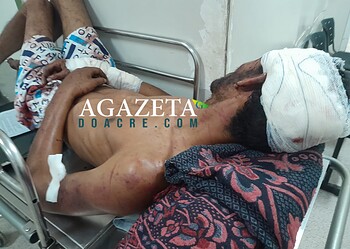 Homem é brutalmente agredido por facção criminosa após ser acusado de furto em Rio Branco