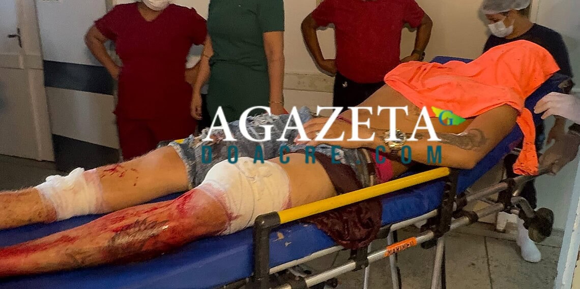 Criminosos em moto chamam adolescente pelo nome e disparam contra ele no Segundo Distrito de Rio Branco