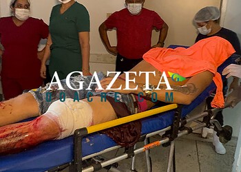 Criminosos em moto chamam adolescente pelo nome e disparam contra ele no Segundo Distrito de Rio Branco