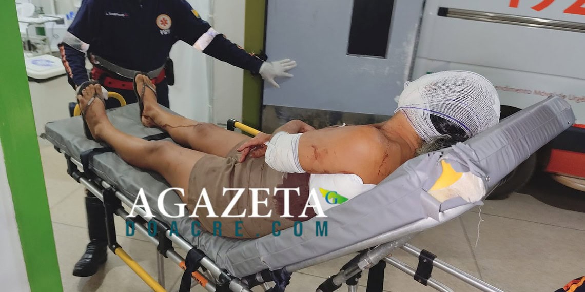 Briga em distribuidora termina com duas mulheres feridas em Rio Branco