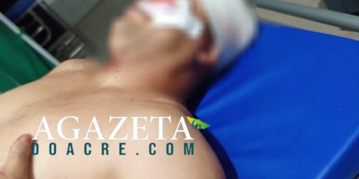 Caminhoneiro catarinense é ferido com um tiro em tentativa de homicídio no Acre