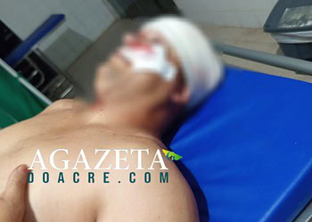 Caminhoneiro catarinense é ferido com um tiro em tentativa de homicídio no Acre