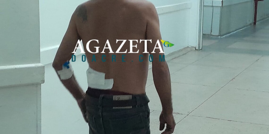 Motociclista é esfaqueado ao tentar impedir assalto na Baixada da Sobral; lâmina quebrou dentro do corpo