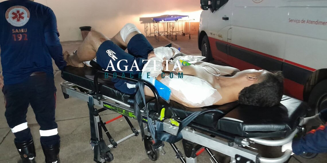Motociclista sofre fratura exposta e ciclista fica ferida em acidente no interior do Acre