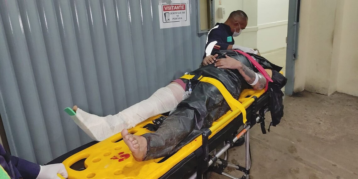 Entregador de lanche sofre fratura na perna após colisão entre carro e moto em Rio Branco
