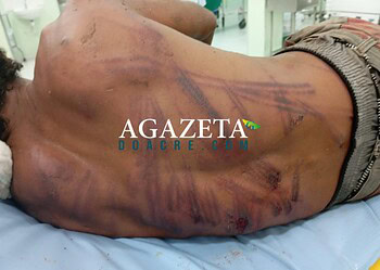 Homem é brutalmente agredido com fio elétrico em 'castigo' de facção em Rio Branco