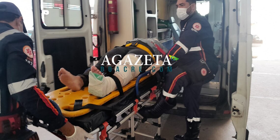 Motociclista sofre fratura após colisão; motorista foge, mas retorna a pé para perguntar sobre vítima