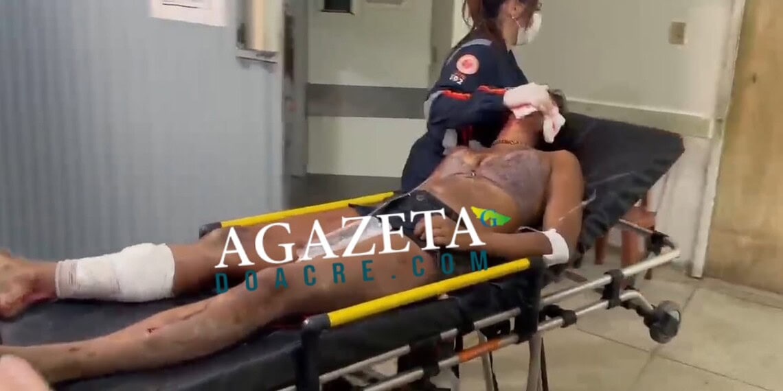 Mulher em situação de rua é atacada por cachorro após invadir residência em Rio Branco