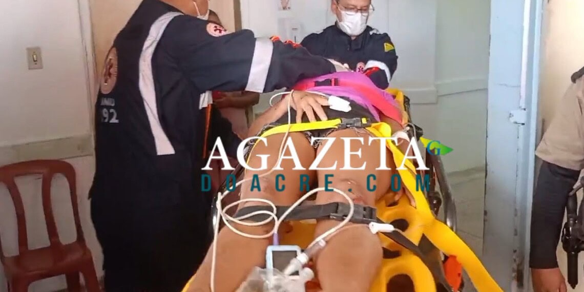 Mulher é atropelada por moto e desmaia após pancada na cabeça no bairro Bosque