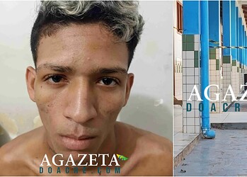 Assaltante baleado no pescoço durante ataque a escola em Rio Branco que terminou com vigilante morto está consciente na UTI