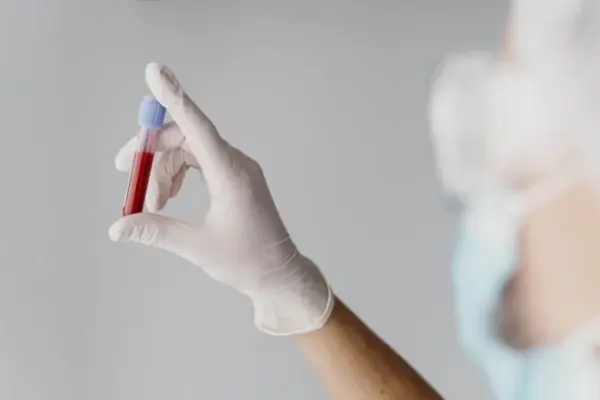 Dia do Lúpus chama a atenção para um mal silencioso