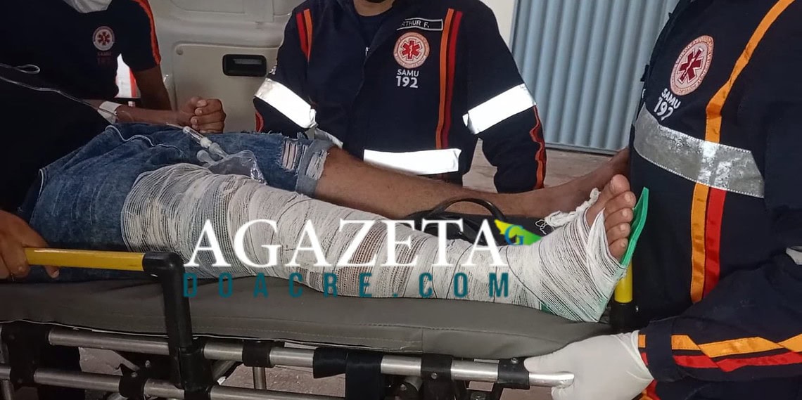 Passageiro de moto por aplicativo se machuca após colisão com ciclista na Baixada da Sobral