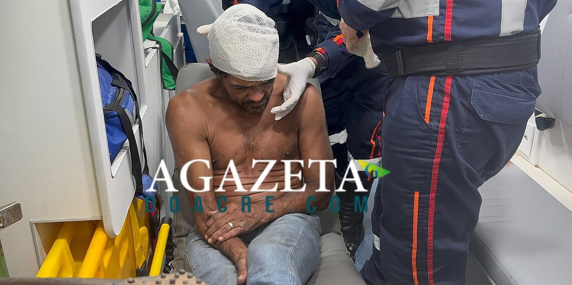 Homem é espancado dentro de casa após ser acusado de furto de sombrinha e sandália em Rio Branco