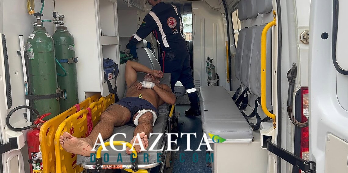 Disparo acidental atinge sargento da PM em residência na Baixada da Sobral