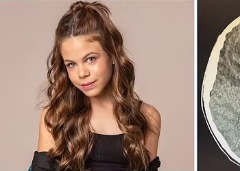 Millena Brandão tinha 11 anos; ao lado foto do exame onde seta do mouse circundada em vermelho mostra mancha suspeita de ser um tumor no cérebro da atriz, segundo a família — Foto: Reprodução/Divulgação