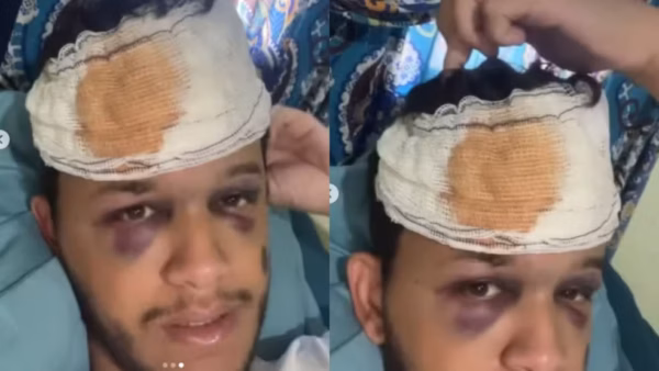 Cantor sertanejo sofre traumatismo craniano durante acidente em rodovia