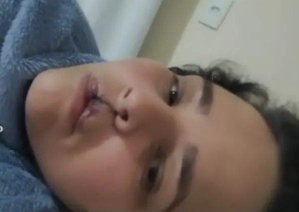 Técnica de enfermagem acreana que foi atacada pelo próprio cachorro passa por primeira cirurgia