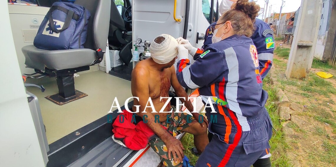 Discussão em casa usada para consumo de drogas termina com homem ferido por golpe de pernamanca em Rio Branco