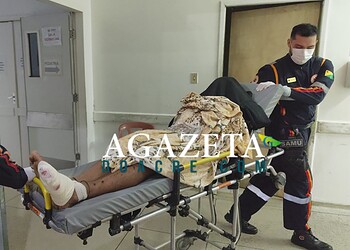 Motociclista sofre amputação após colisão com carro em ramal de Rio Branco