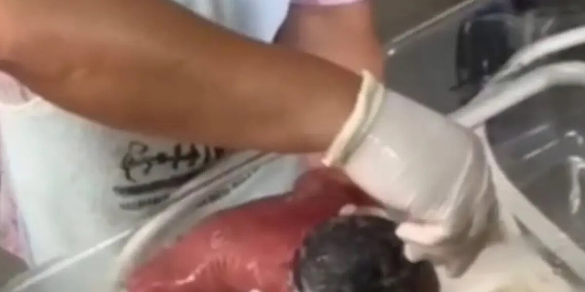 Caso Aurora: Técnica nega que água estivesse quente em banho de bebê e diz estar recebendo ameaças