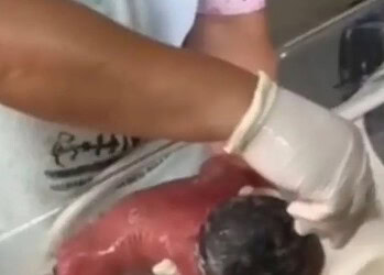 Caso Aurora: Técnica nega que água estivesse quente em banho de bebê e diz estar recebendo ameaças