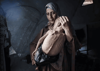 O bebê Muhammad e sua mãe foram deslocados de sua casa no norte de Gaza e, como muitas pessoas na Faixa de Gaza, estão sofrendo de desnutrição — Foto: Ahmed Jihad Ibrahim Al-arini/Anadolu via Getty Images