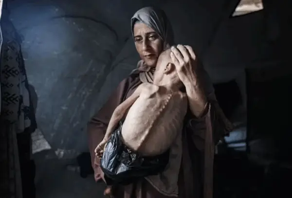 A história por trás da chocante foto do bebê faminto de Gaza