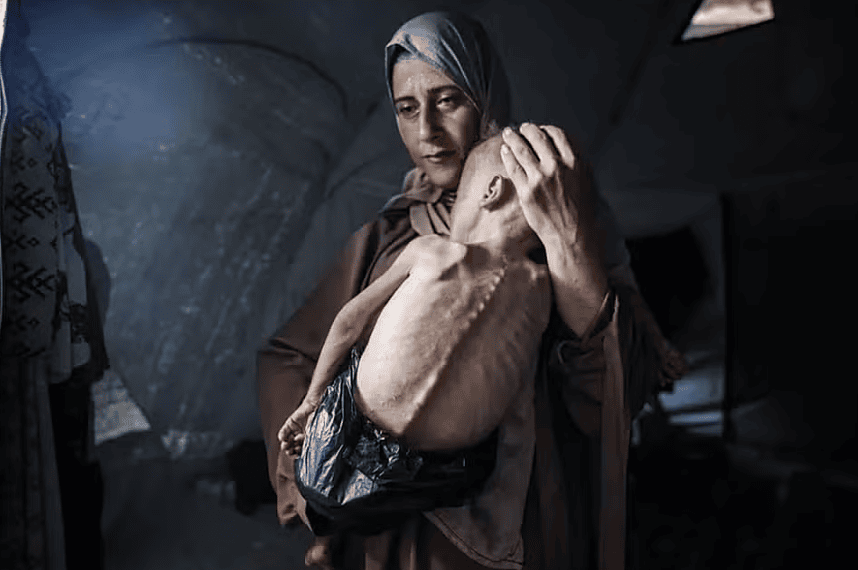 O bebê Muhammad e sua mãe foram deslocados de sua casa no norte de Gaza e, como muitas pessoas na Faixa de Gaza, estão sofrendo de desnutrição — Foto: Ahmed Jihad Ibrahim Al-arini/Anadolu via Getty Images