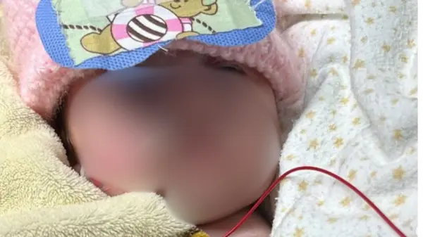 Bebê Aurora segue na UTI em tratamento de queimaduras e apresenta sinais de recuperação: "seguimos em oração"