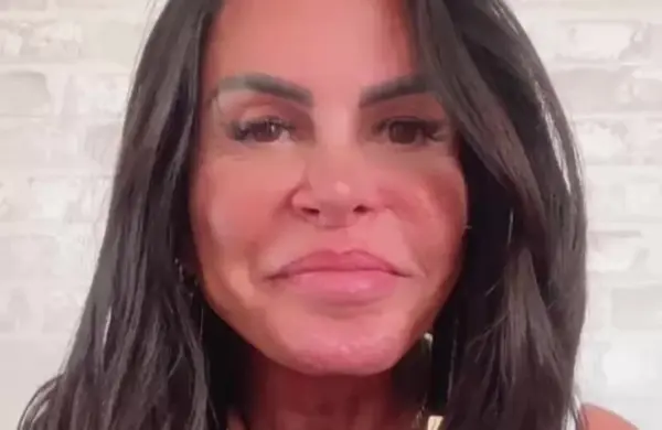 Gretchen revela diagnóstico de depressão e ansiedade após Power Couple
