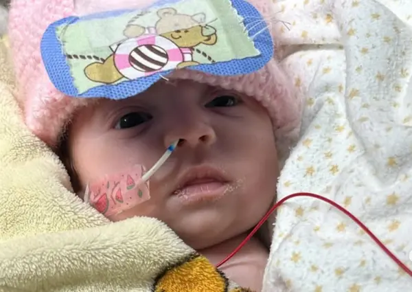 Bebê que sofreu queimaduras em hospital no Acre deixa UTI em BH e segue tratamento